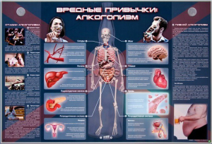 Электрифицированный стенд "Вредные привычки: алкоголизм" - fgospostavki.ru - Норильск